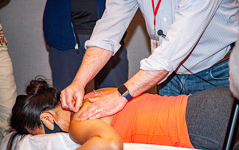 Dry Needling Acupuncture Workshop by AcuMed